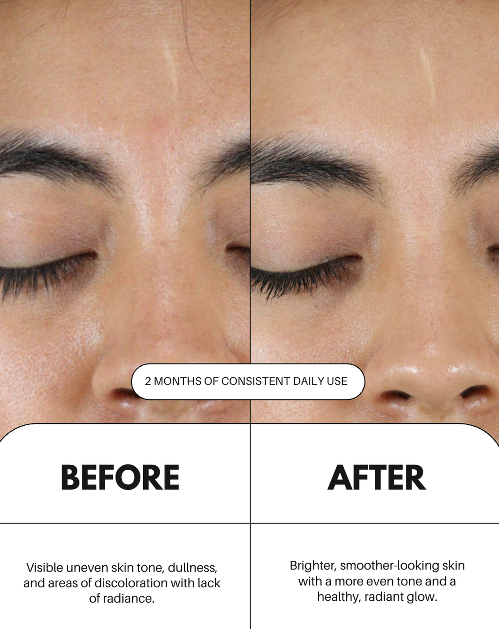 Vitamin C Serum For Face