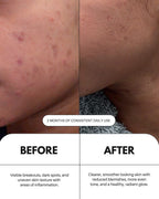 Vitamin C Serum For Face